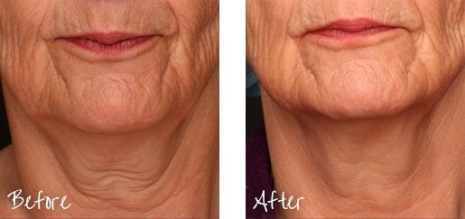 We can help you look younger without surgery.